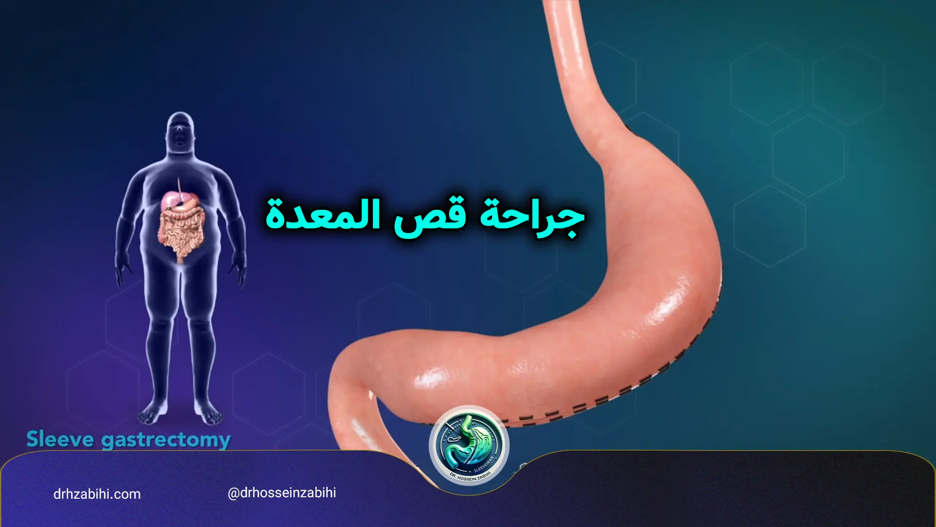 أهمية رعاية ما بعد الجراحة