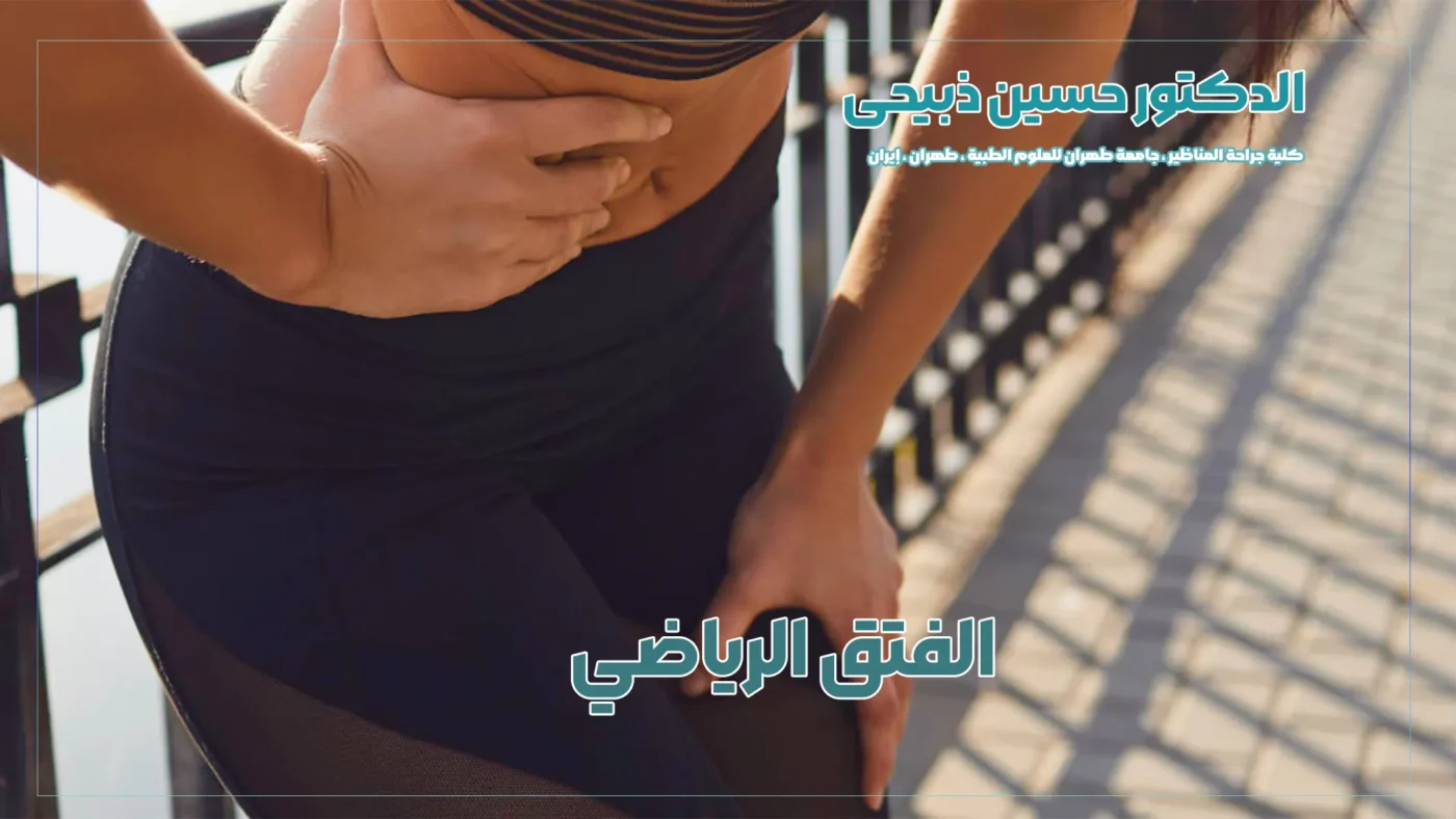 الفتق الرياضي