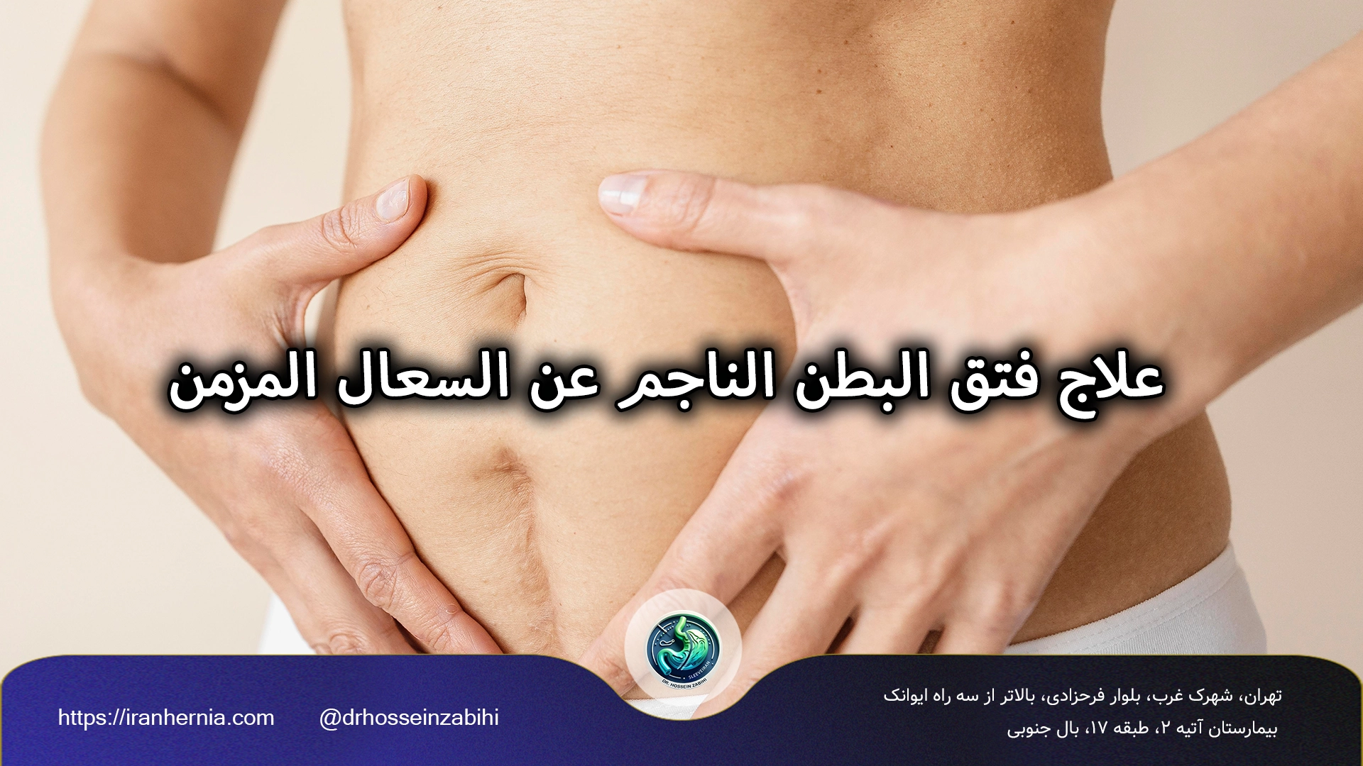 السعال المزمن وفتق البطن