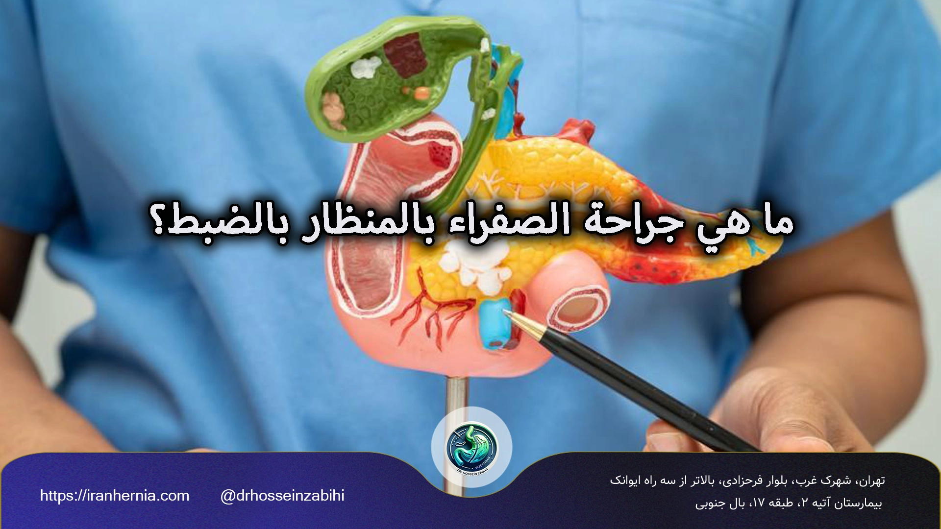 ما هي جراحة الصفراء بالمنظار بالضبط؟