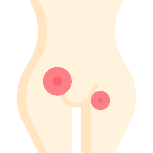 جراحة فتق البطن