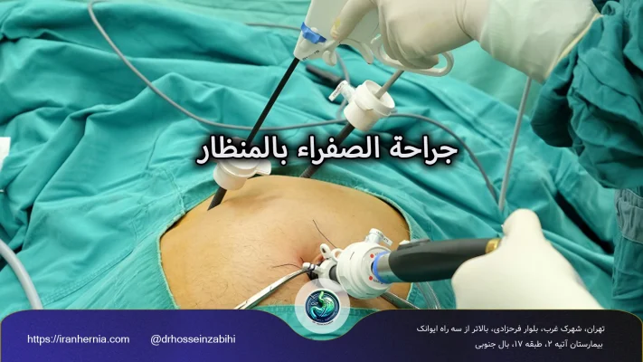 جراحة الصفراء بالمنظار