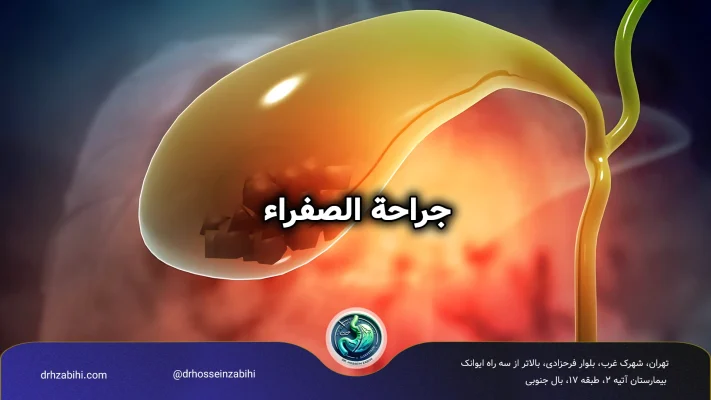جراحة الصفراء